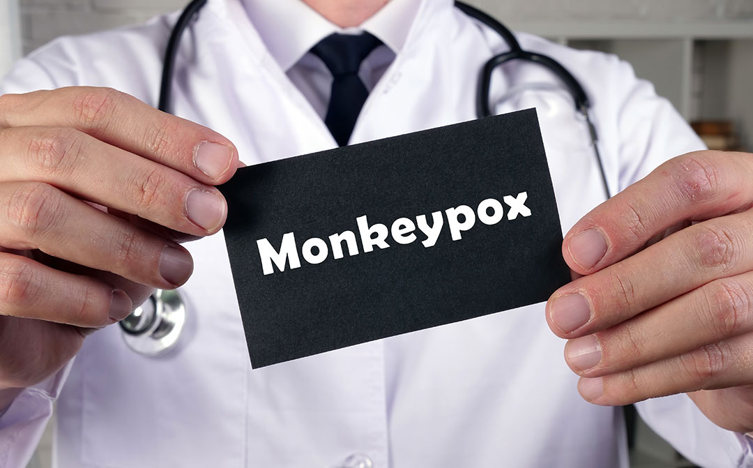 monkey pox and employers